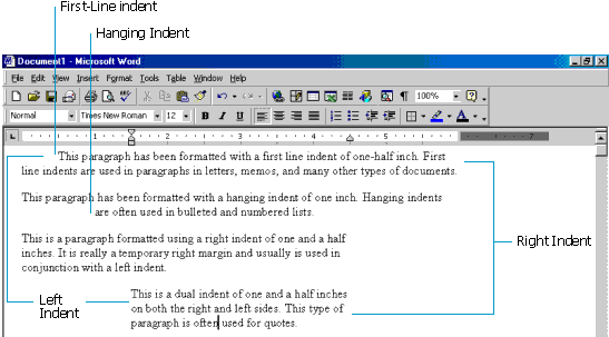 Diagram of the kinds of indents in a Microsoft Word document